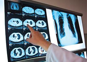 A technician points to a specific point on an x-ray placed against a light